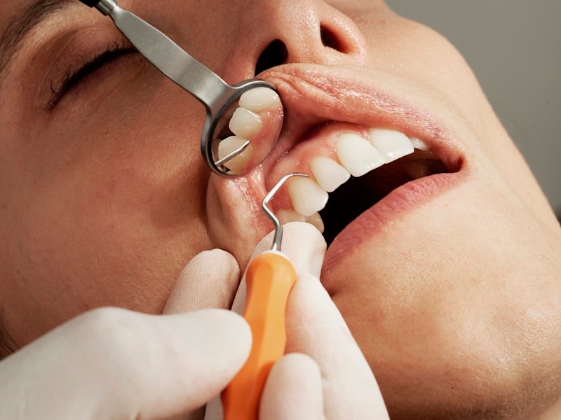 Close-up of a routine dental hygiene check with mirror