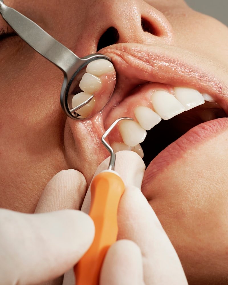 Close-up of a periodontal cleaning showing gum-line care